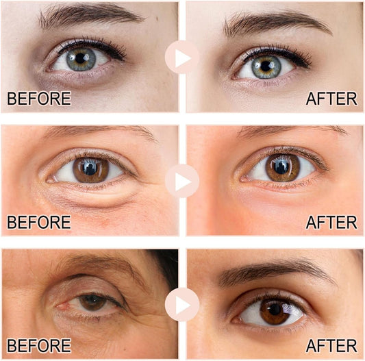 Retinol Intense Reactivating Eye Cream,Retinol Eye Cream,Dark Circles under Eye Treatment Women,Anti Aging Eye Cream,Eye Cream for Dark Circles and Puffy Eyes,Eye Bags Remover,Eye Cream for Wrinkles