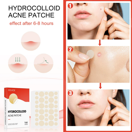 Invisible Hydrocolloid Acne Patches – 144 Pcs