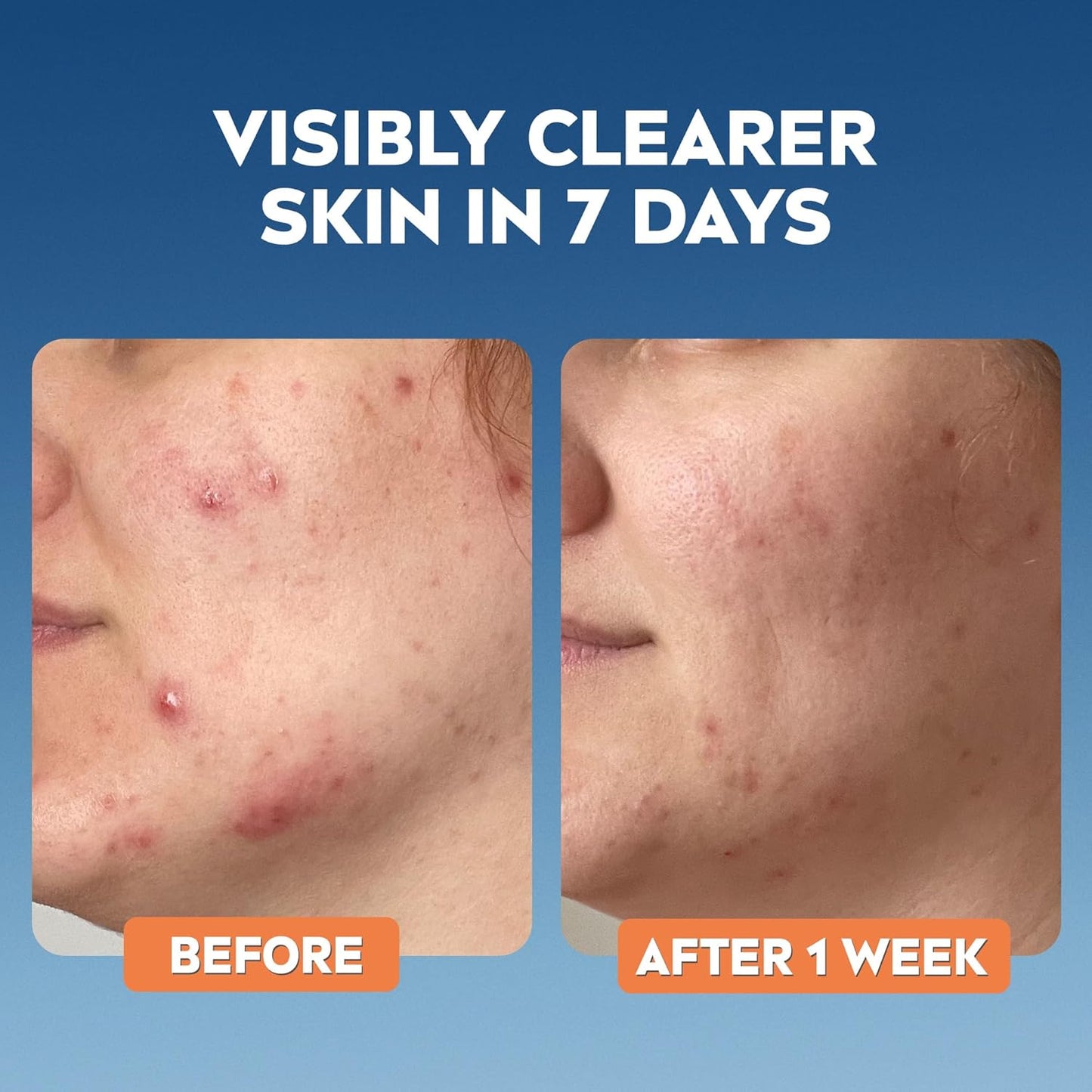 Derma Skin Clear Toner (200Ml), Cleansing and Hydrating, Salicylic Acid Toner Enriched with Niacinamide to Rebalance the Skin and Remove Impurities