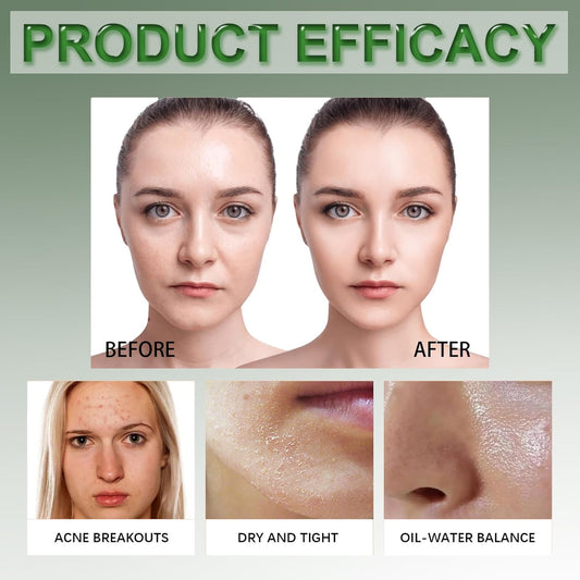 Centella Toner Pads 60PCS - Skin Care for Teenage Girls - Face Exfoliator Pad with Aloe,Centella and Btaine - Face Pads for Cleansing Pores,Calming - Exfoliating and Cleansing Pad