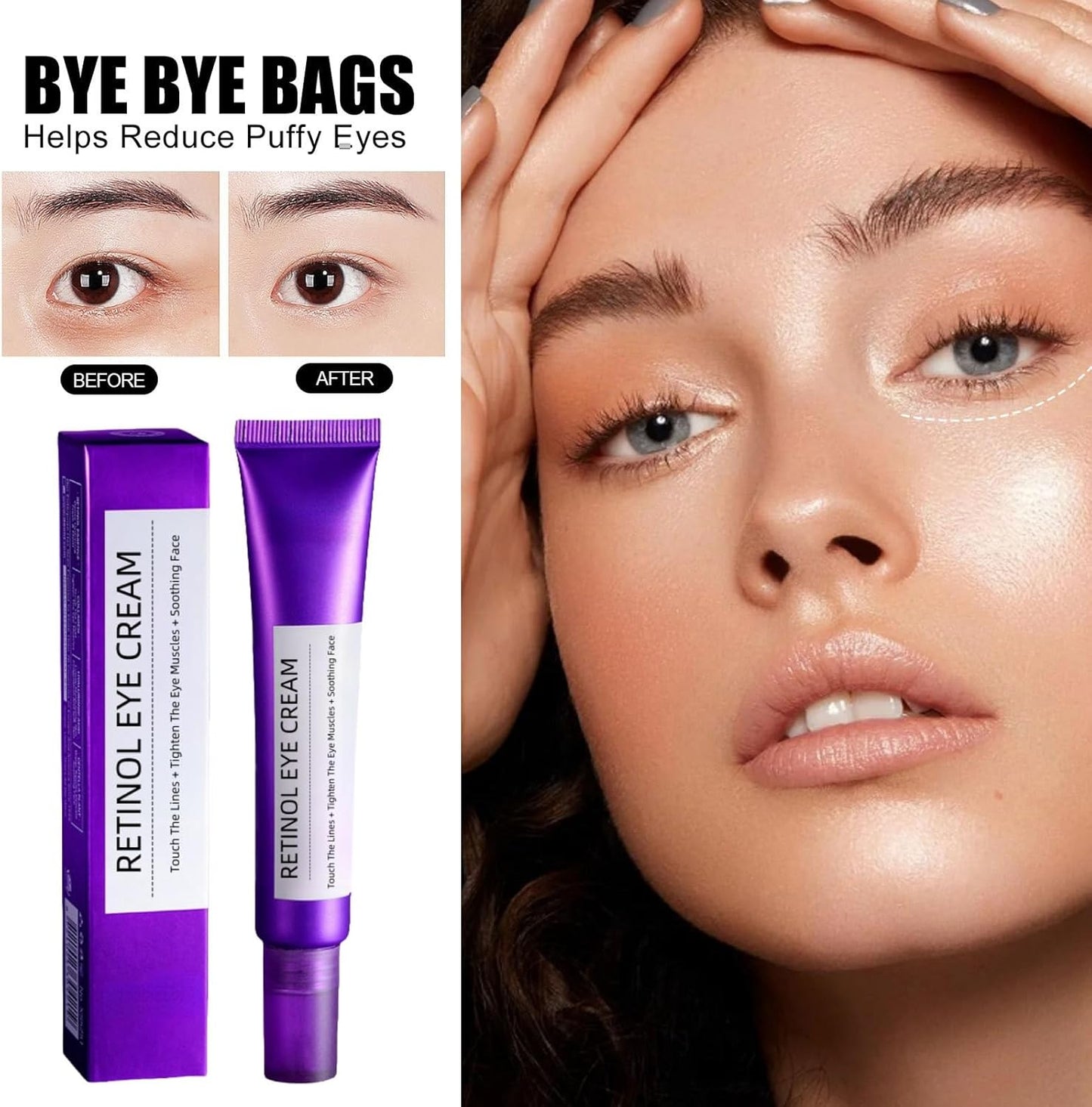 Retinol Intense Reactivating Eye Cream,Retinol Eye Cream,Dark Circles under Eye Treatment Women,Anti Aging Eye Cream,Eye Cream for Dark Circles and Puffy Eyes,Eye Bags Remover,Eye Cream for Wrinkles