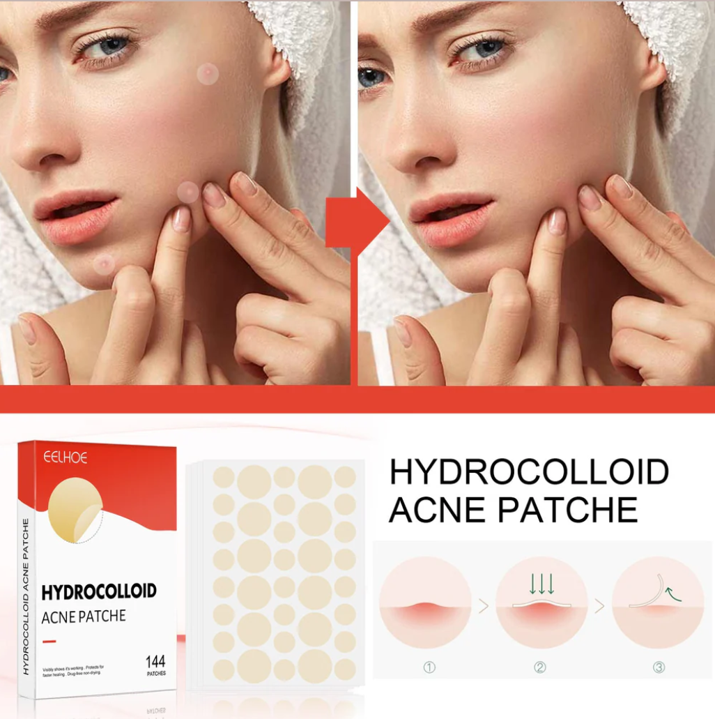Invisible Hydrocolloid Acne Patches – 144 Pcs