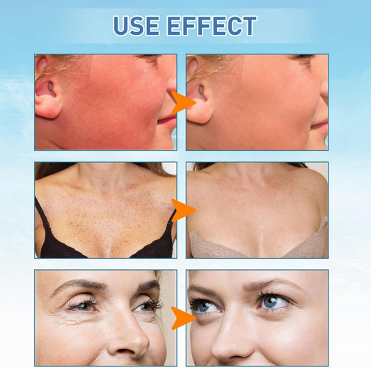 Korean Sunscreen,Birch Juice Moisturizing Sun Cream,Korean Sunscreen SPF50 Face Moisturizing Sunscreen,Moist Essence Type,Strong UV Protection,Korean Facial Sunscreen,For All Skin Types